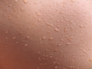 10 obiceiuri care te ajuta in lupta cu acneea